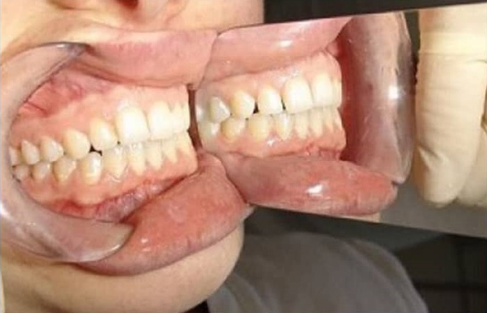 دستگاه آمالگاماتور دندانپزشکی